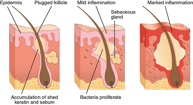 Determining Your Skin Condition