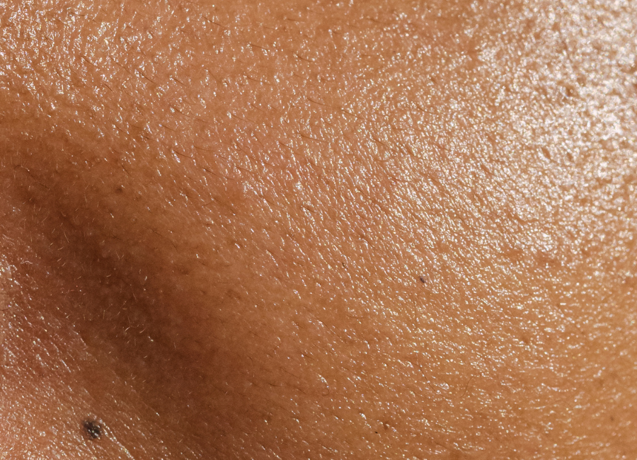 facial pores