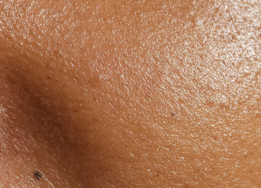 facial pores