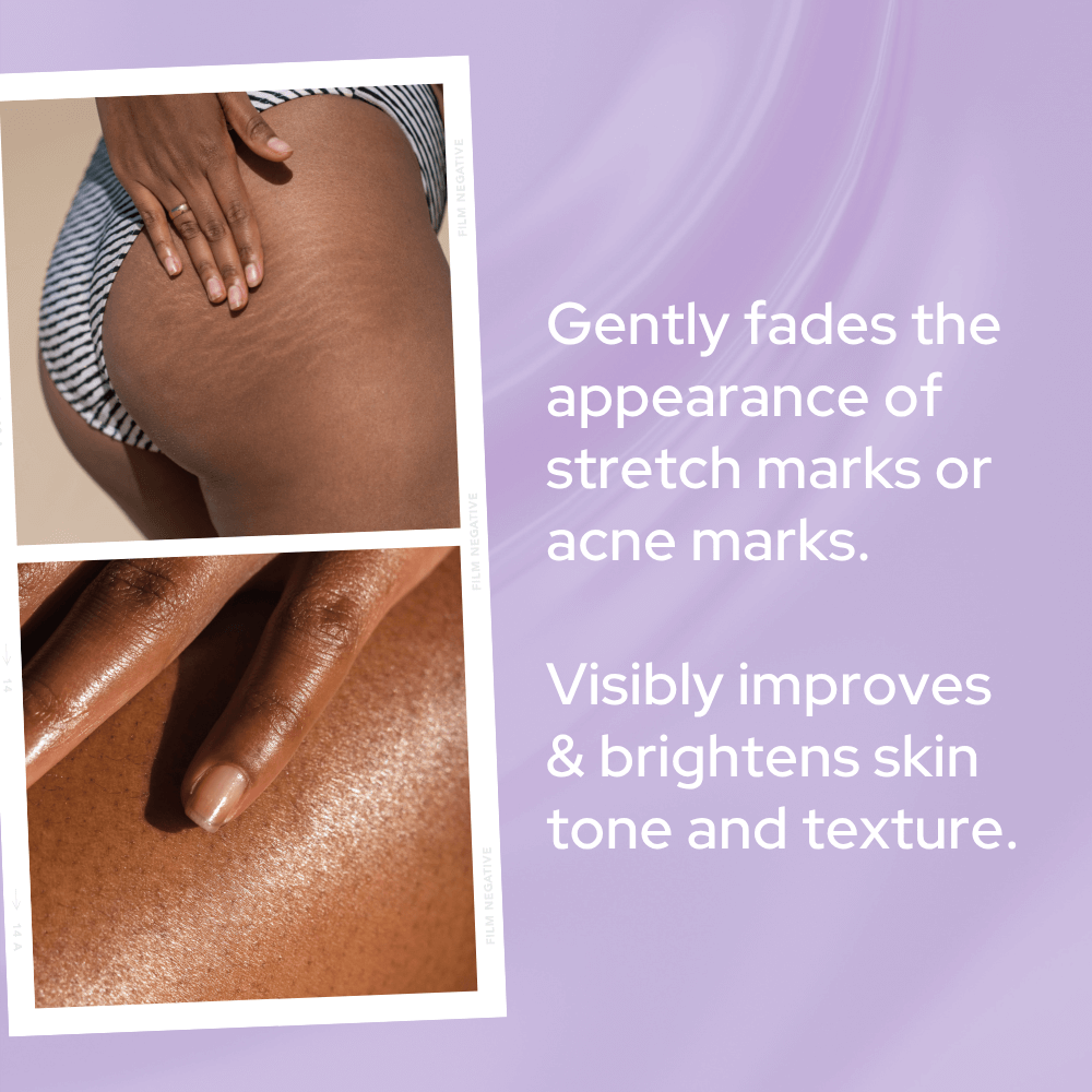 Power Glow | Scar & Stretch Mark Repair