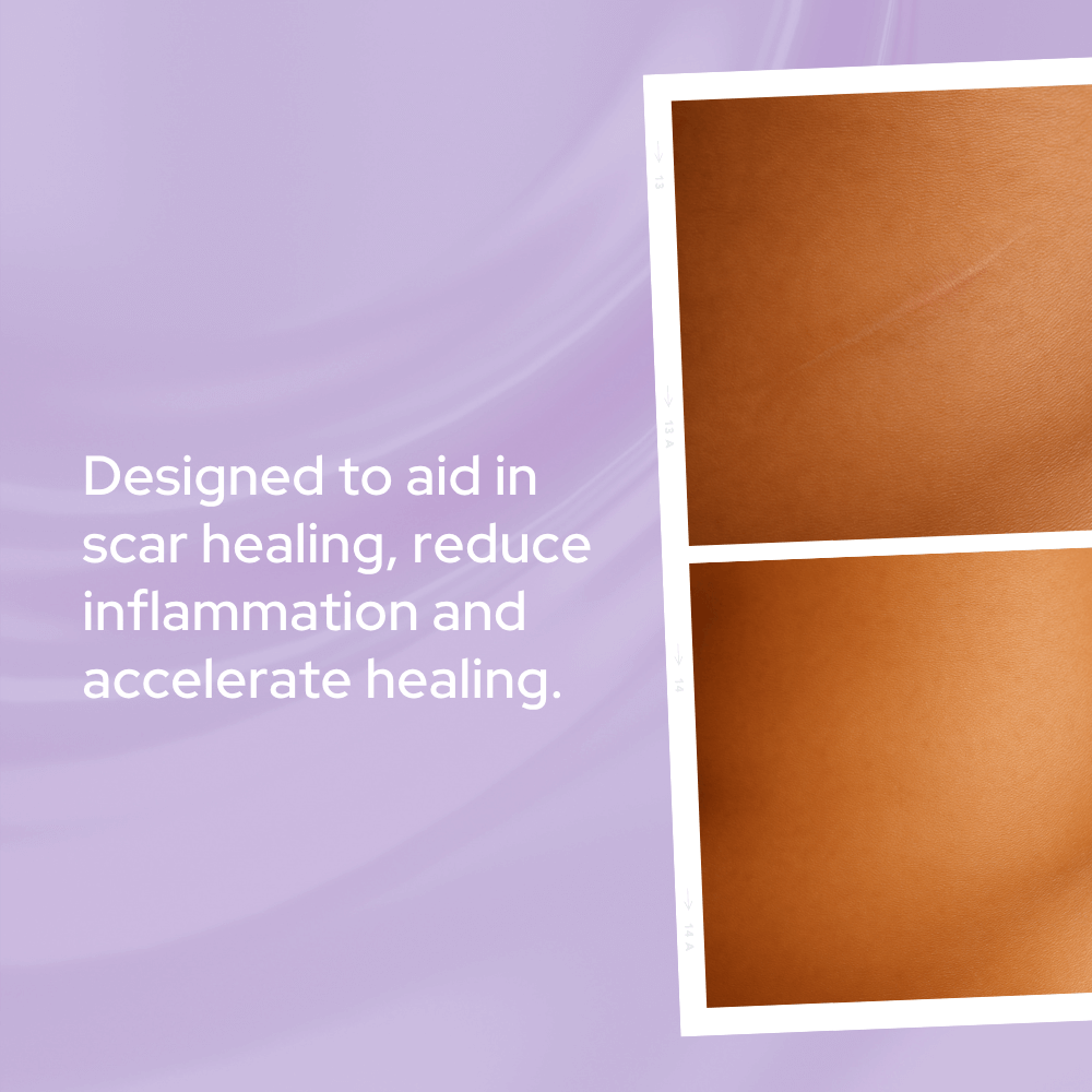 Power Glow | Scar & Stretch Mark Repair